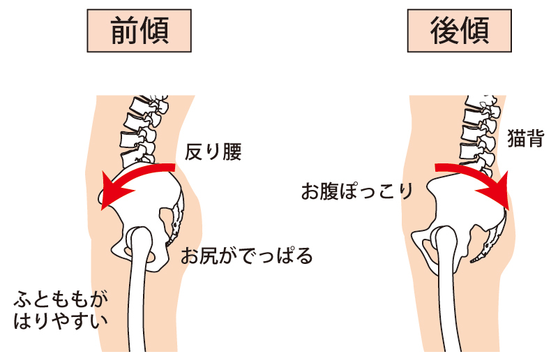 腰痛,種類,原因