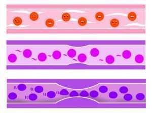 肩こり,腕のしびれ