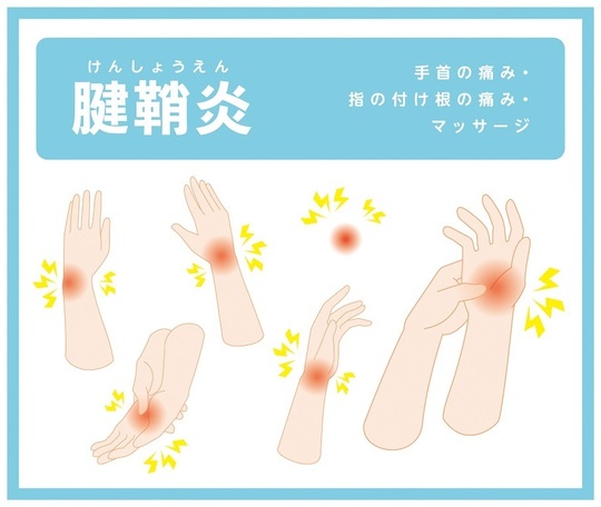 腱鞘炎,和歌山