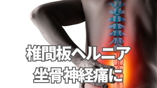 椎間板ヘルニア・坐骨神経痛に